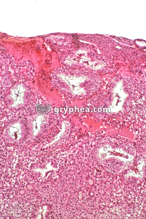 Endomètre phase sécrétoire x25 - gryphea.com